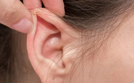 إعادة تشكيل الأذن: كيفية الحفاظ على النتائج