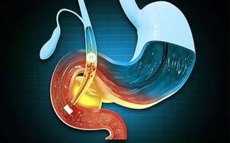 Recurring Upper Abdominal Pain? It Might Be Time to See a Gallbladder Specialist