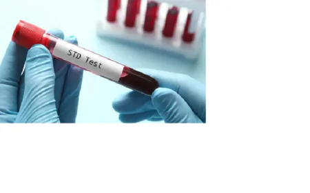 STD test in Dubai: Why Regular Screening is Vital for You