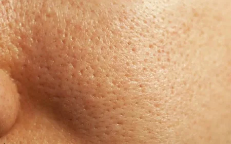 How Large Pores Treatment Targets Skin Structure?