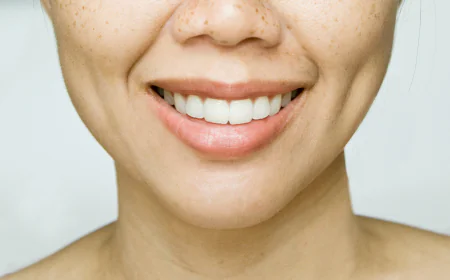 How Does Dimple Creation Surgery Affect Faces?