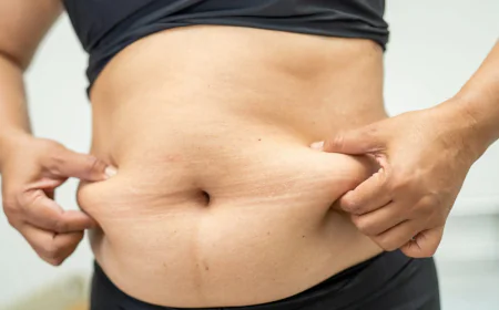 When Is Lipo Abdominoplasty the Best Option?