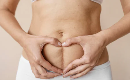 What to Expect in Cesarean Section Process?