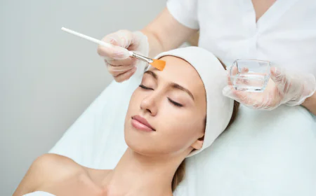 How Chemical Peels Reduce Acne?