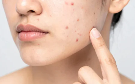 Can Stress Cause Skin Problems? Understanding the Link Between Mind and Skin