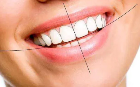 Is Smile Designing Treatment Worth It? Benefits and Expectations