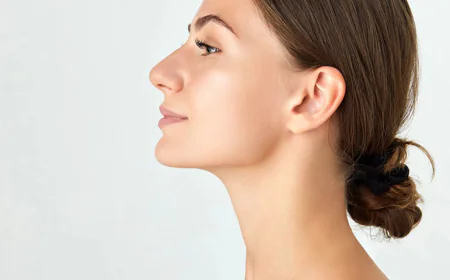 How Does Kybella Target and Reduce Double Chin Fat?