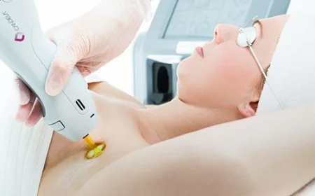 Laser Hair Removal in Dubai: Advanced Clinical Paths to Smooth Skin