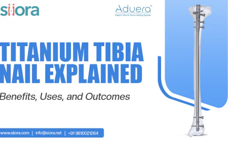 Titanium Tibia Nail Explained: Benefits, Uses, and Outcomes