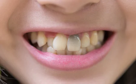 Can a Dentist Fix a Black Tooth? Causes and Treatment Options
