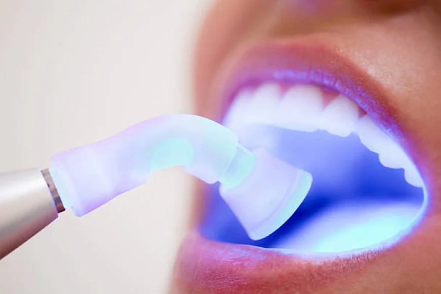 Everything You Need to Know About Dental Fillings for a Healthy Smile
