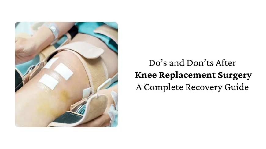 Do’s and Don’ts After Knee Replacement Surgery: A Complete Recovery Guide