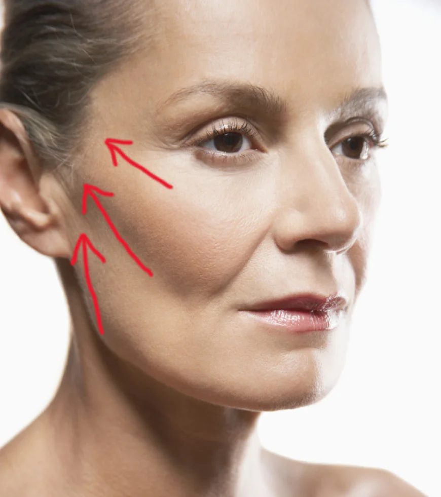 Is a Vector Facelift Safe for Both Men and Women?
