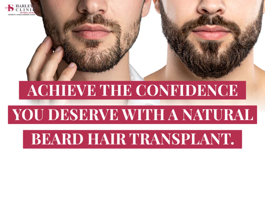 Is Beard Hair Transplant Worth Investing?