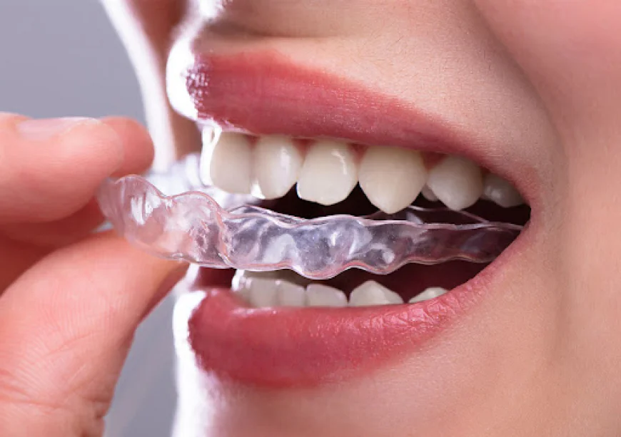 What Are Dental Aligners and How Do They Work?