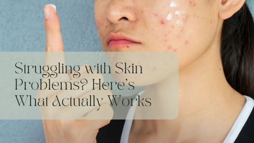 Struggling with Skin Problems? Here’s What Actually Works