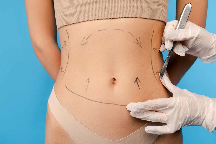 Is Liposuction a Safe Fat Removal Procedure?
