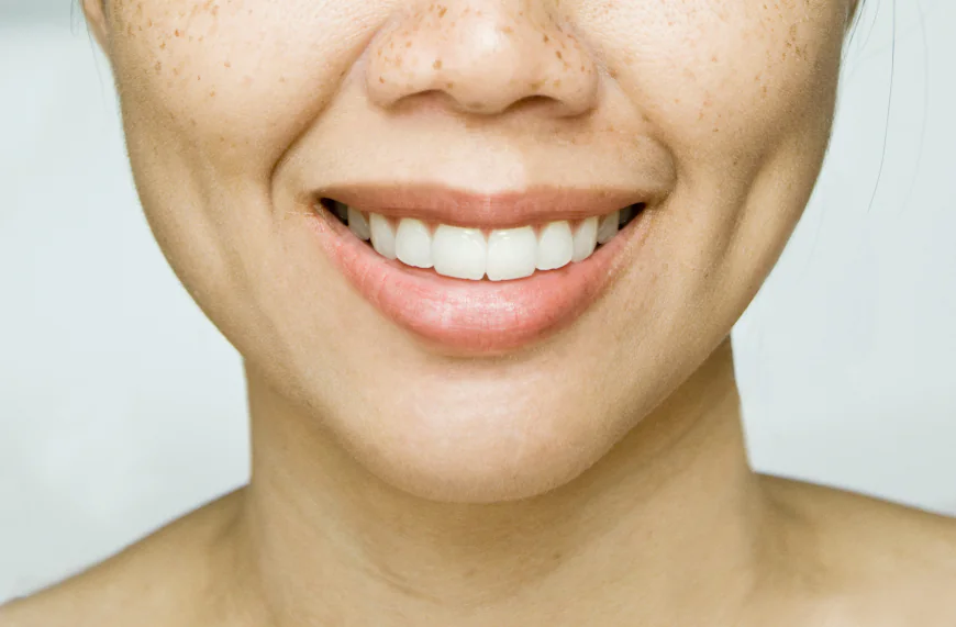 How Does Dimple Creation Surgery Affect Faces?