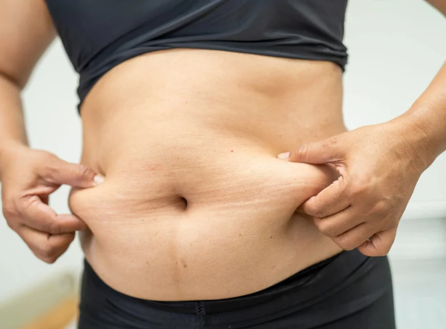 When Is Lipo Abdominoplasty the Best Option?