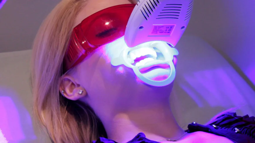Teeth Whitening Cost in Dubai: Dental Whitening Dubai