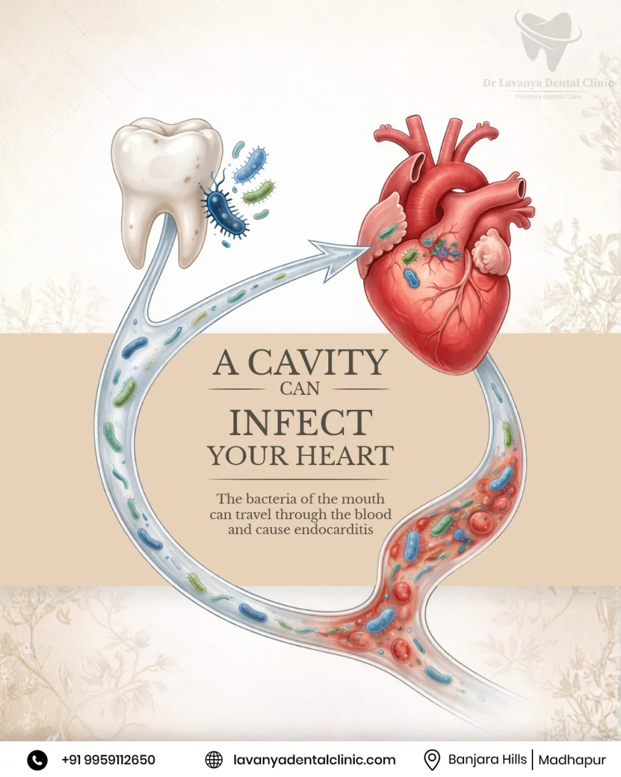 Best Dental Caries Treatment in Hyderabad & Protect Your Smile with Advanced Care