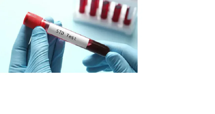 The Link Between Lifestyle and Routine STD Test in Dubai Protocols