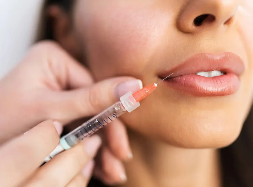 How Do Lip Fillers Injections Work?