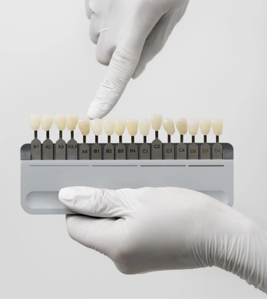 Veneers in Dubai: Your Complete Guide to a Confident, Lasting Smile