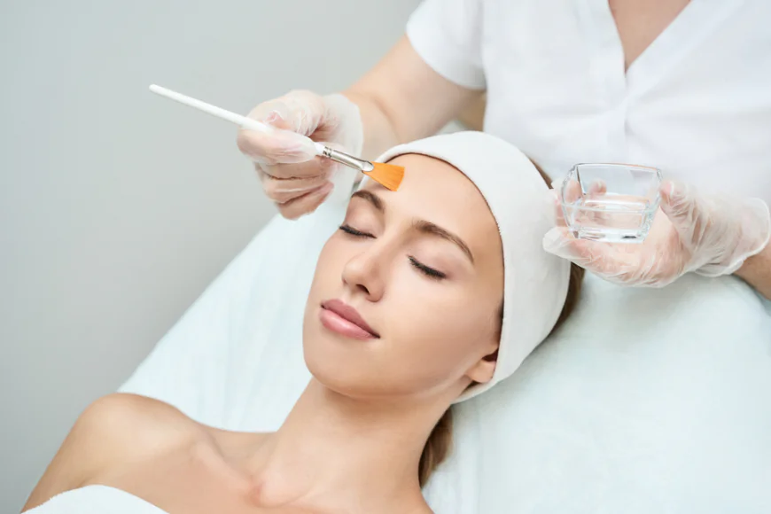 How Chemical Peels Reduce Acne?