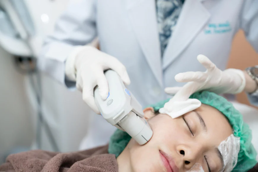 HIFU and Ultherapy Face Lifts in the Philippines: What to Expect