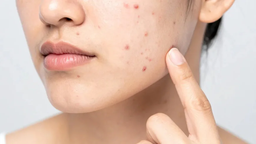 Can Stress Cause Skin Problems? Understanding the Link Between Mind and Skin