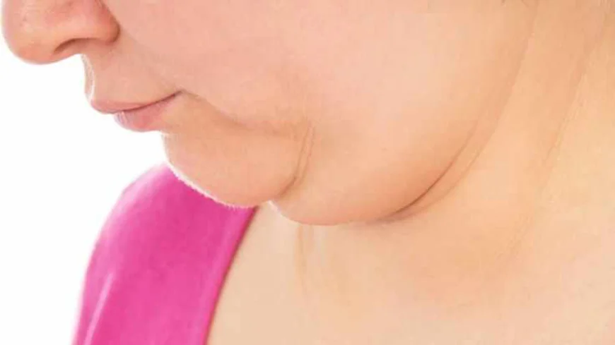 Best Clinic Double Chin Liposuction Islamabad