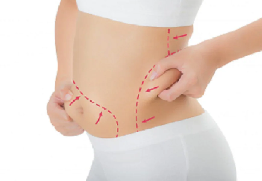 Fat melting injection in Dubai: Achieve a Slimmer Profile