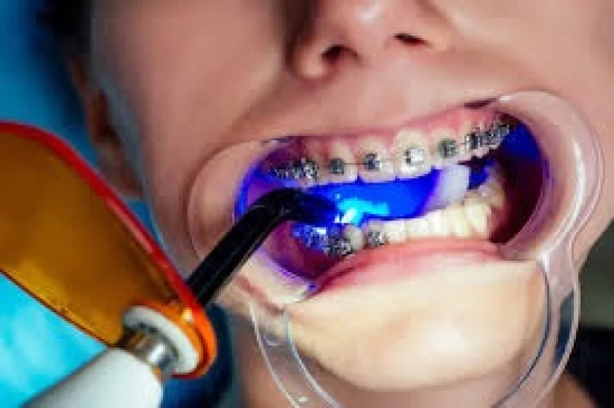 What Services Does an Orthodontist in Miami Shores Offer?