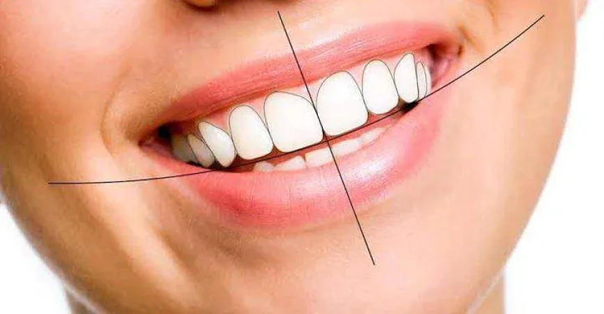 Is Smile Designing Treatment Worth It? Benefits and Expectations