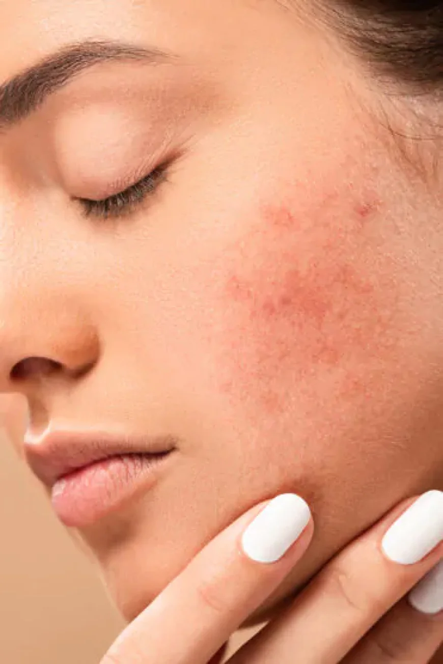 Skin Psoriasis Treatment: Best Solutions That Work
