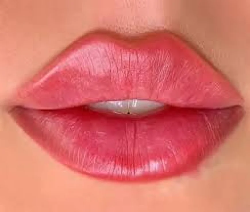 Does Russian Lip Fillers Preserve Lip Border Definition
