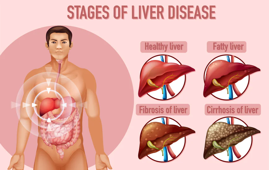Liver Detox Myths vs Facts: What Really Works for Liver Health?