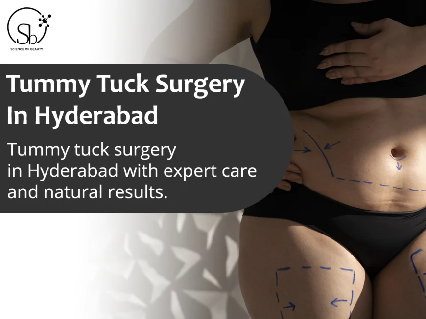 5 Things to Consider Before Booking a Tummy Tuck