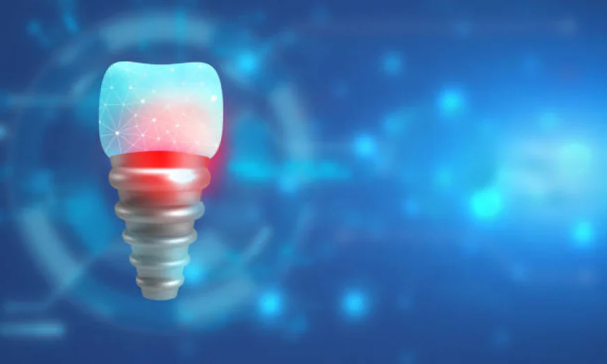 The Anatomy of Longevity: Protecting the Implant-Abutment Interface