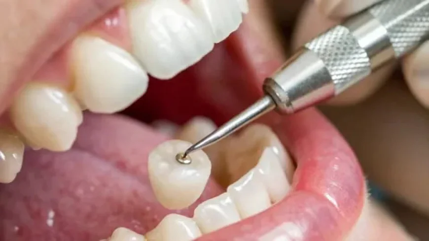 Dental Crown Treatment in Islamabad – Restoring Strength, Function, and Smile Aesthetics
