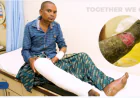 Need Donation for Medical Treatment: Why Financial Support Has Become Essential