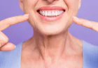 Teeth Whitening in Dubai: Step-by-Step Treatment Guide