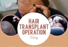 Hair Transplant Operation Turkey: What You Need to Know Before Choosing a Clinic