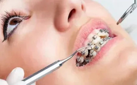 Fractured Teeth Treatment in Islamabad – Restore Your Smile Effectively
