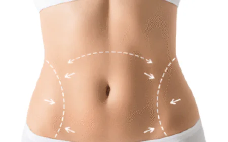 Liposuction in Dubai: Advanced Body Contouring Technology