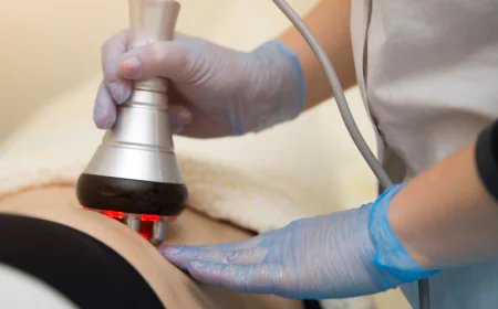 How Cellulite Treatment Relates to Fat Layers