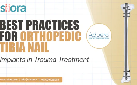 Best Practices for Orthopedic Tibia Nail Implants in Trauma Treatment