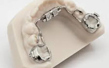 How Do Dental Activators Improve Jaw Alignment?