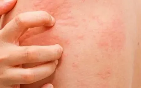 Can Skin Diseases Be Treated Effectively?